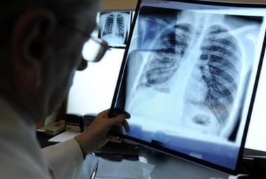 Вопросы профилактики туберкулеза обсудили в Душанбе