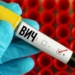 В Гиссаре выявлены 24 новых ВИЧ-инфицированных