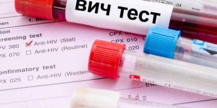 Тест на ВИЧ для мальчиков перед обрезанием в Таджикистане стал обязательным