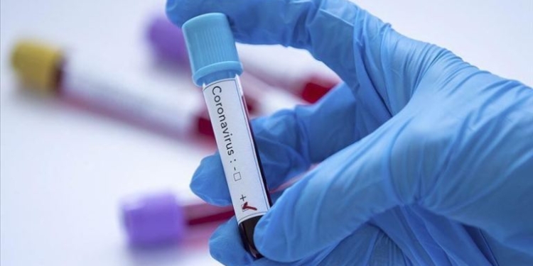 Число больных COVID-19 в Афганистане превысило 2 тыс. человек