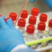 В Афганистане число инфицированных COVID-19 превысило 3 тыс человек.