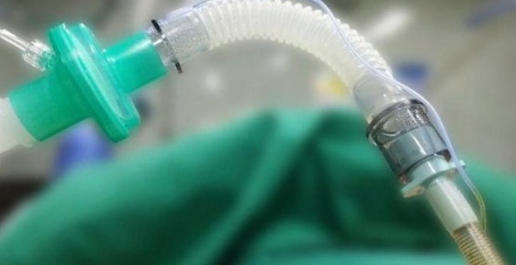 В Таджикистане планируют наладить производство отечественного аппарата ИВЛ