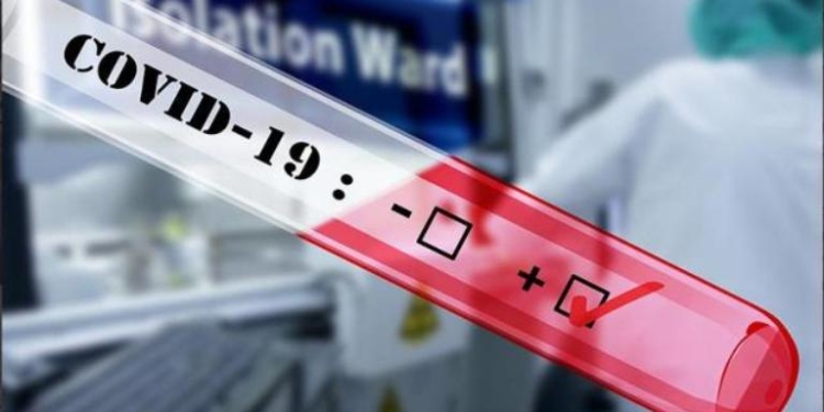 38 новых случаев инфицирования COVID-19 зарегистрировано в Таджикистане