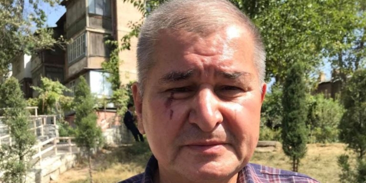 Лидер СДПТ Р.Зойиров сообщил, что на него напали неизвестные
