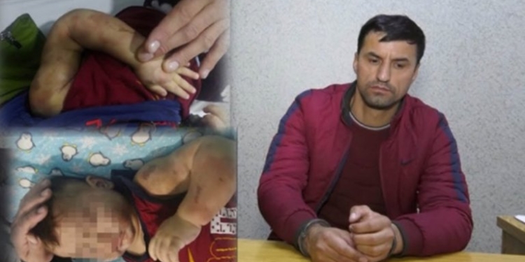 В Бустоне отчим искусал своего малолетнего пасынка. Истязатель задержан (видео)