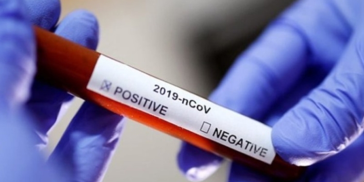 В Таджикистане выявлено 39 новых случаев инфицирования COVID-19