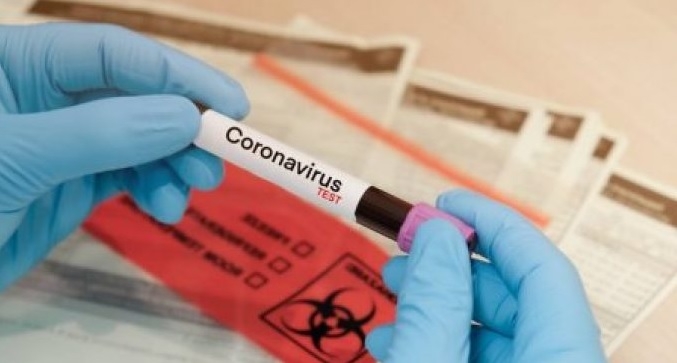 В Таджикистане зафиксировано 32 новых случаев заражения COVID-19