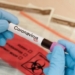 В Таджикистане зафиксировано 32 новых случаев заражения COVID-19