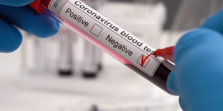 В Таджикистане за сутки выявлено 18 новых случаев заражения COVID-19
