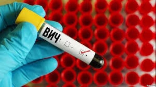 Общее число ВИЧ-инфицированных в Таджикистане составляет более 10,5 тыс.